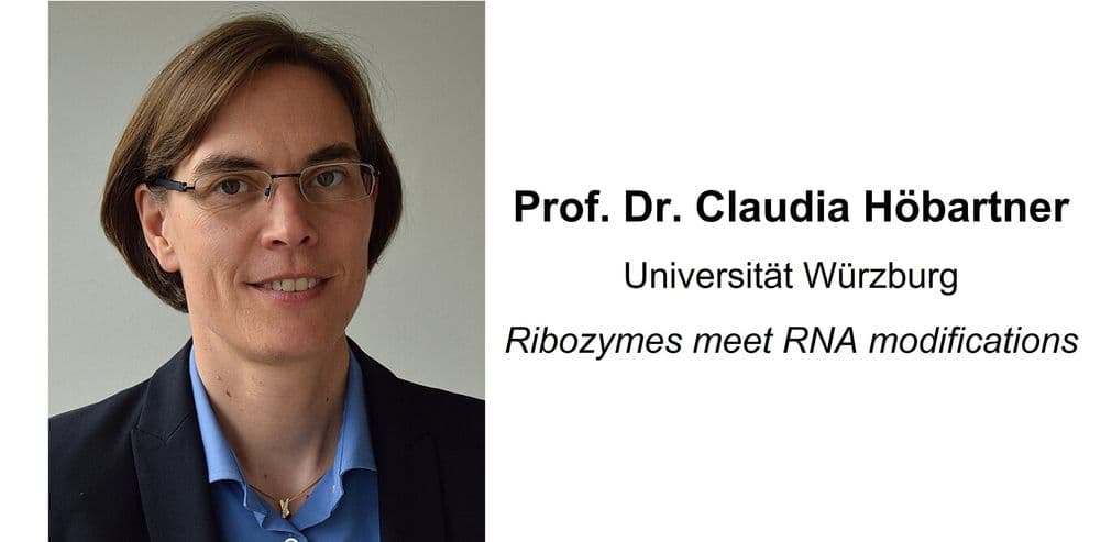 Ribozymes meet RNA modifications