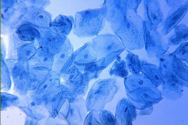 Das blaue Wunder: Methylenblau – zwischen Hoffnungsträger und Hype