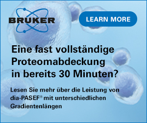 Anzeige Bruker
